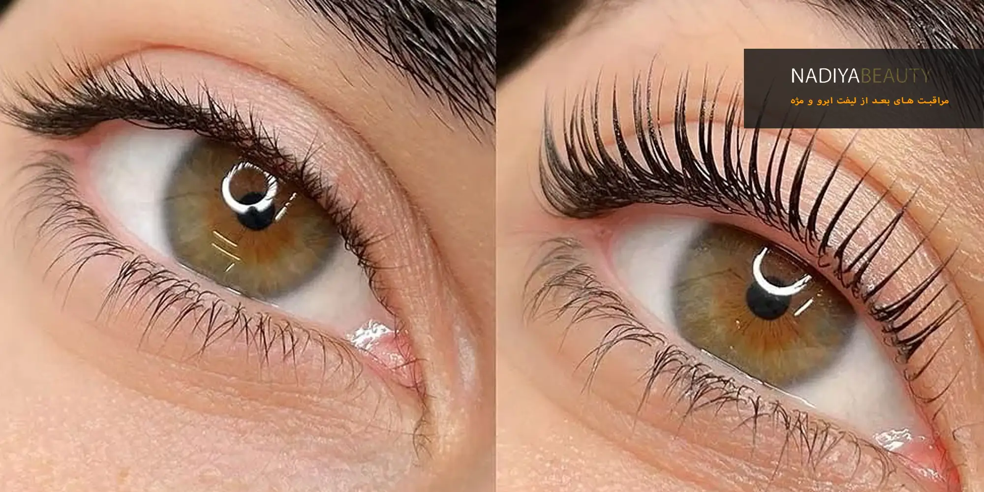 مراقبت های بعد از لیفت ابرو و مژه