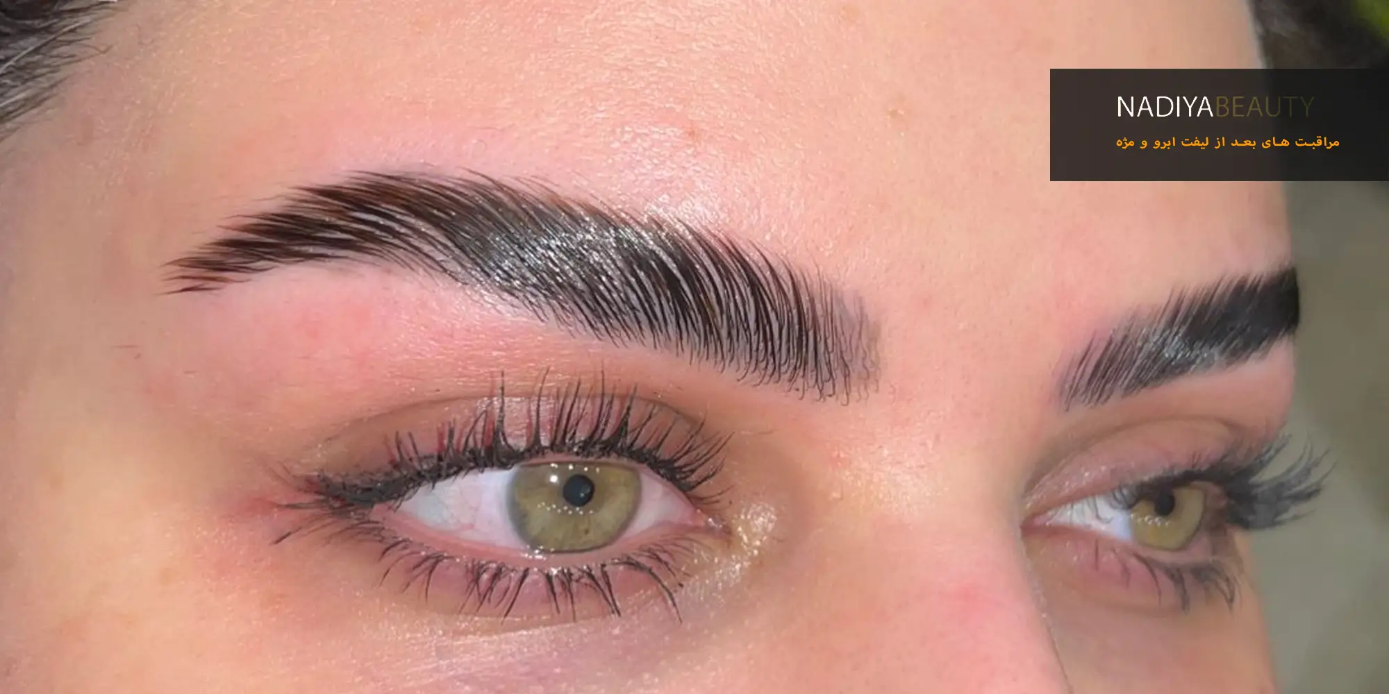 مراقبت های بعد از لیفت ابرو و مژه