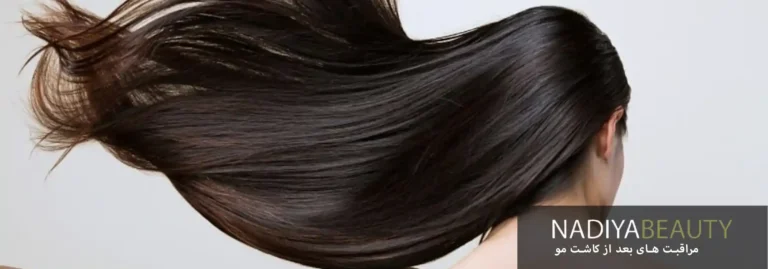 مراقبت های بعد از کاشت مو