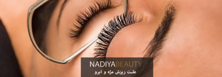 علت ریزش مژه و ابرو