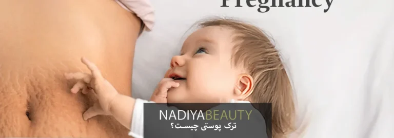 ترک پوستی چیست